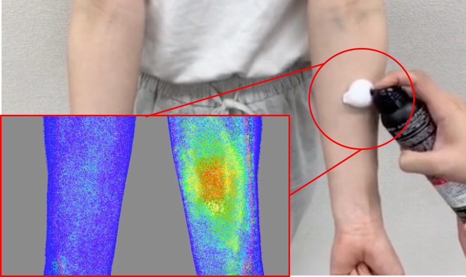 hair lossing improved image02