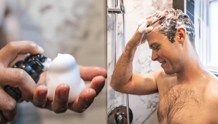 hair lossing improved image02